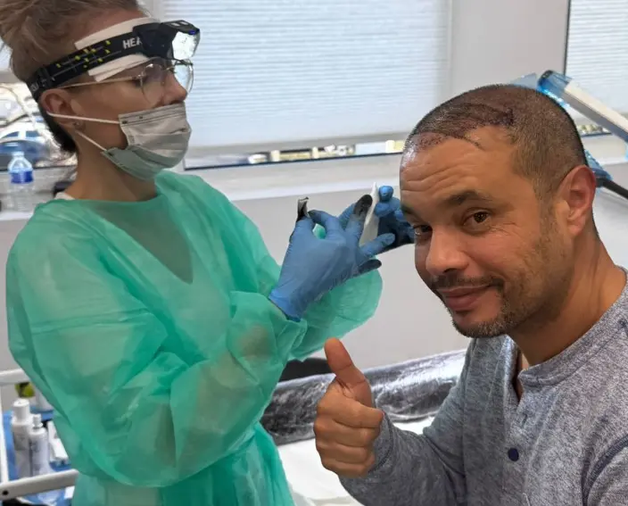 Patient souriant pendant une séance de tricopigmentation capillaire, effet densité cheveux courts