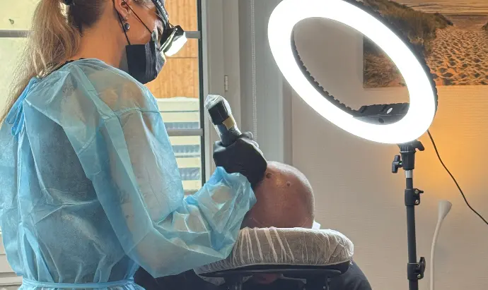 Technicienne réalisant une tricopigmentation capillaire