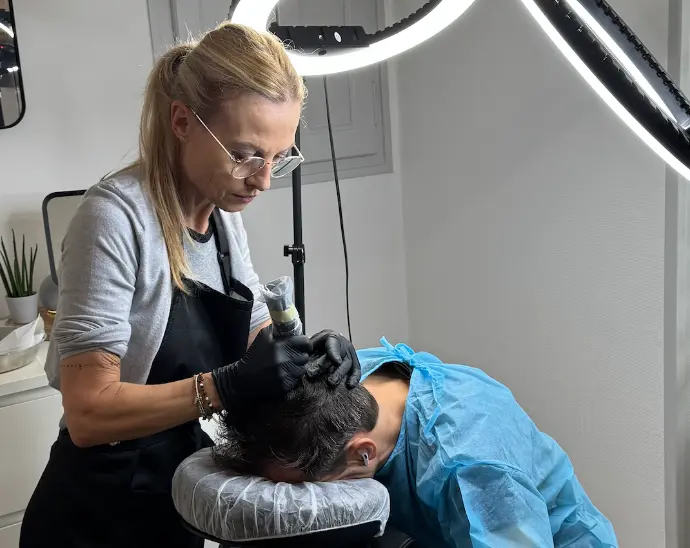 Détail d’une séance de pigmentation capillaire avec aiguille fine sur cuir chevel