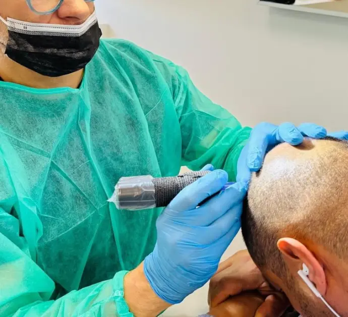 Praticien réalisant une tricopigmentation capillaire sur vertex dégarnie.