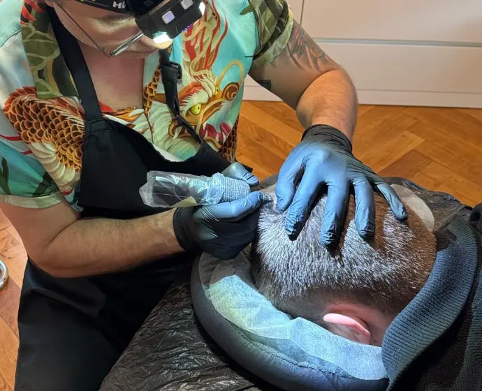 Praticien réalisant une tricopigmentation capillaire sur cheveux court