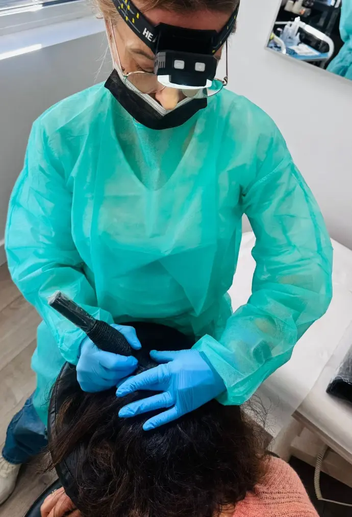 Tricopigmentation capillaire sur femme avec alopécie diffuse pour redonner de la densité